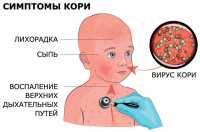 В каком регионе России злобствует корь